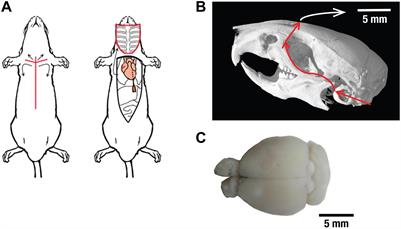 Isolated Murine Brain Model for Large-Scale Optoacoustic Calcium Imaging